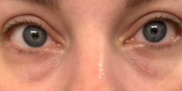 EyeBeauty Pro 4 489745164324045618 01bf5f0b 1d22 4e31 8ddf 6d02039b5b0c