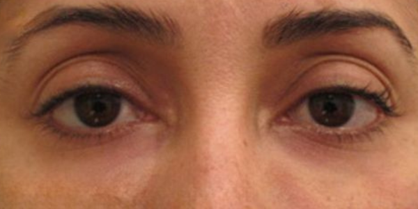 EyeBeauty Pro 7 489745164324045618 02929fd6 c69e 4244 b2c5 b3a317a7161d
