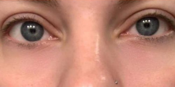 EyeBeauty Pro 5 489745164324045618 284fffd9 0428 4501 a590 a296e65d713a