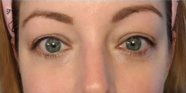 EyeBeauty Pro 3 489745164324045618 b2536286 13ab 4268 8f0d 2b11865daaac