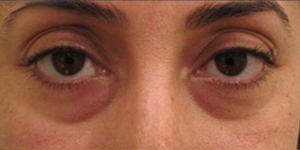 EyeBeauty Pro 6 489745164324045618 f2b1b13d 8c99 4bbb 8216 8bc0f42c710b
